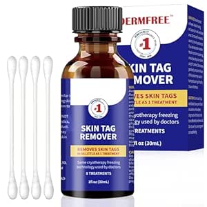 Read more about the article 30ml Haut Etikettenentferner, Stielwarzen Entfernen Schnell, Skin Tag Remover Kit