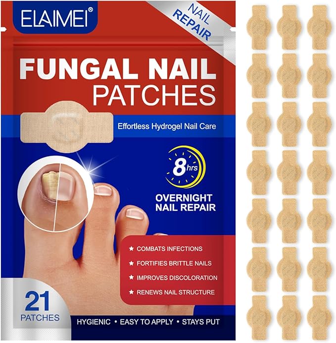 Read more about the article Nail fungus