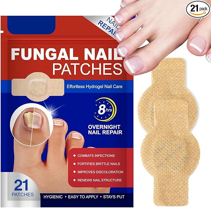 Read more about the article Fungal nail treatment