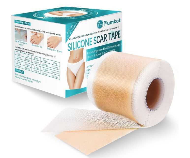 Read more about the article silicone scar sheets