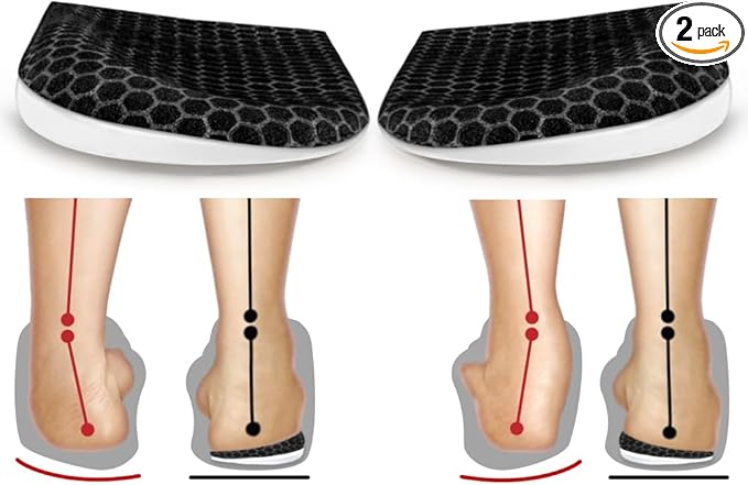 Read more about the article lateral heel
