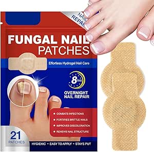 Read more about the article Fungal Nail Treatment