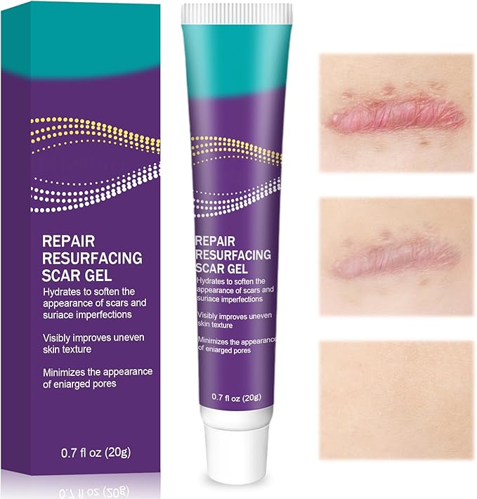 Read more about the article Scar cream
