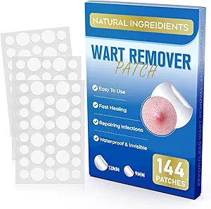 Read more about the article Wart remover