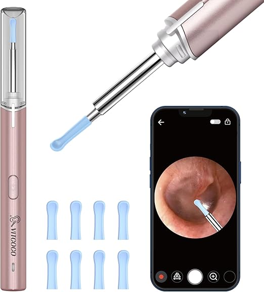 Read more about the article Ohrenschmalz Entferner Otoskop, VITCOCO 1080P Ohrenreiniger