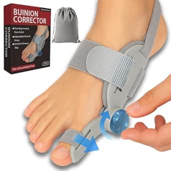 Read more about the article bunion corrector